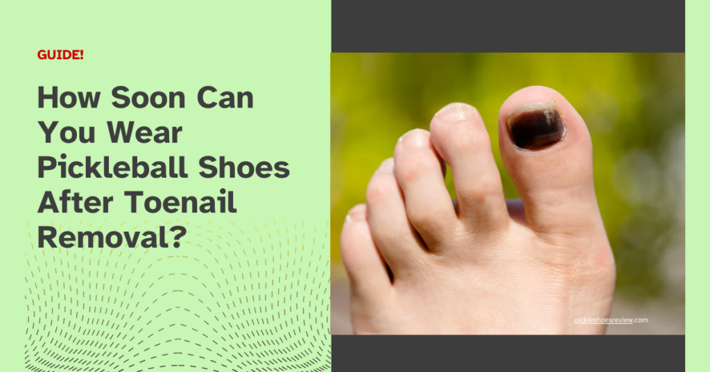 How Soon Can You Wear Pickleball Shoes After Toenail Removal