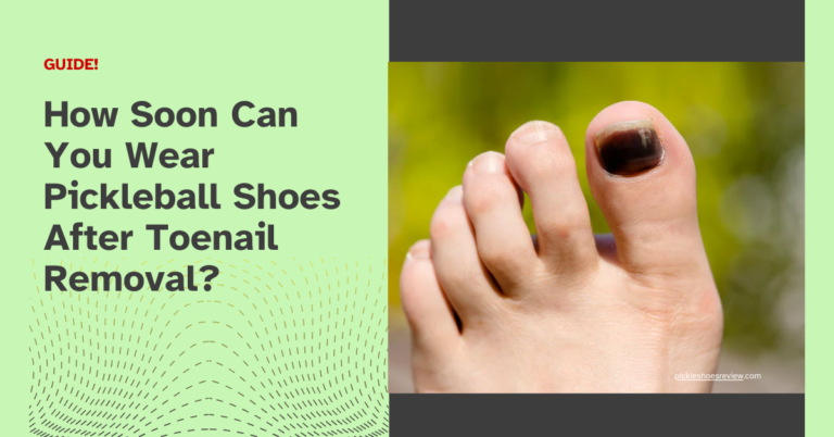 How Soon Can You Wear Pickleball Shoes After Toenail Removal?